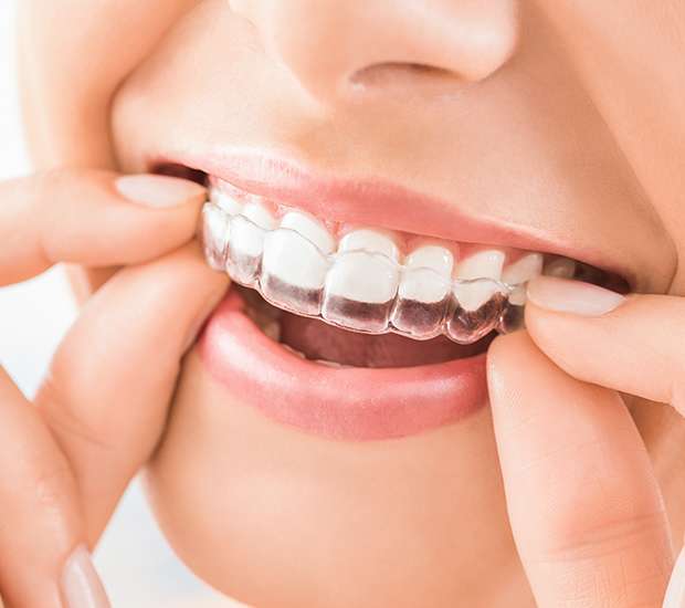 San Juan Capistrano Does Invisalign Really Work